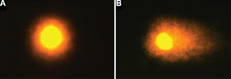 Comet assay of cumulus cells: (A) intact and (B) fragmented comet tail DNA.